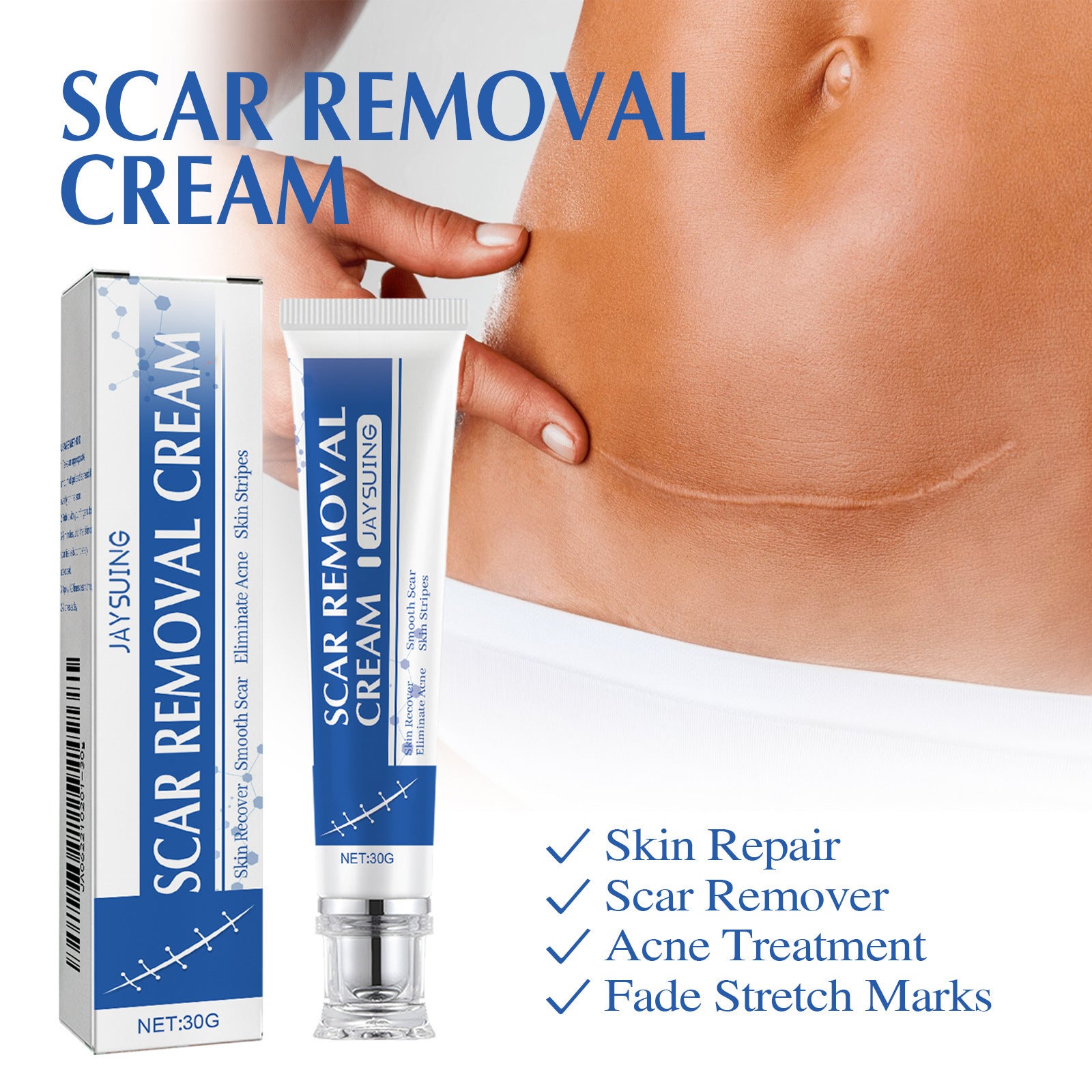 SmoothSkin™ Scar Repair & Anti-Wrinkle Cream