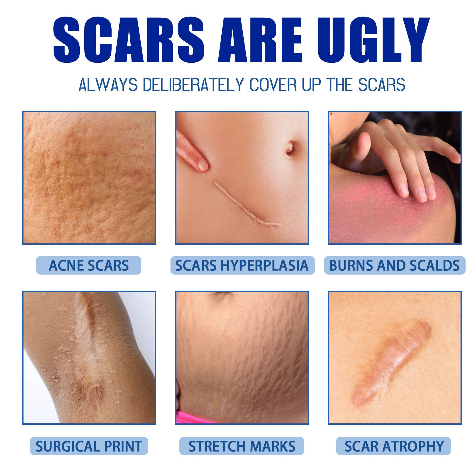 SmoothSkin™ Scar Repair & Anti-Wrinkle Cream