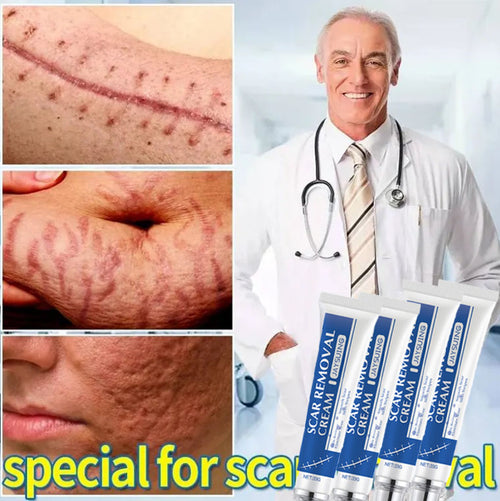 SmoothSkin™ Scar Repair & Anti-Wrinkle Cream