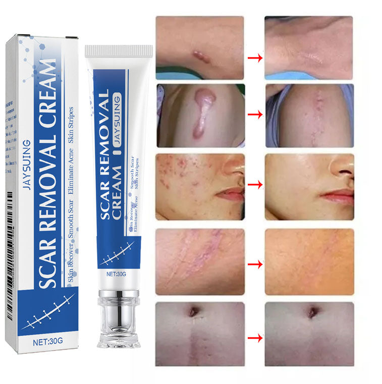 SmoothSkin™ Scar Repair & Anti-Wrinkle Cream