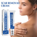 SmoothSkin™ Scar Repair & Anti-Wrinkle Cream